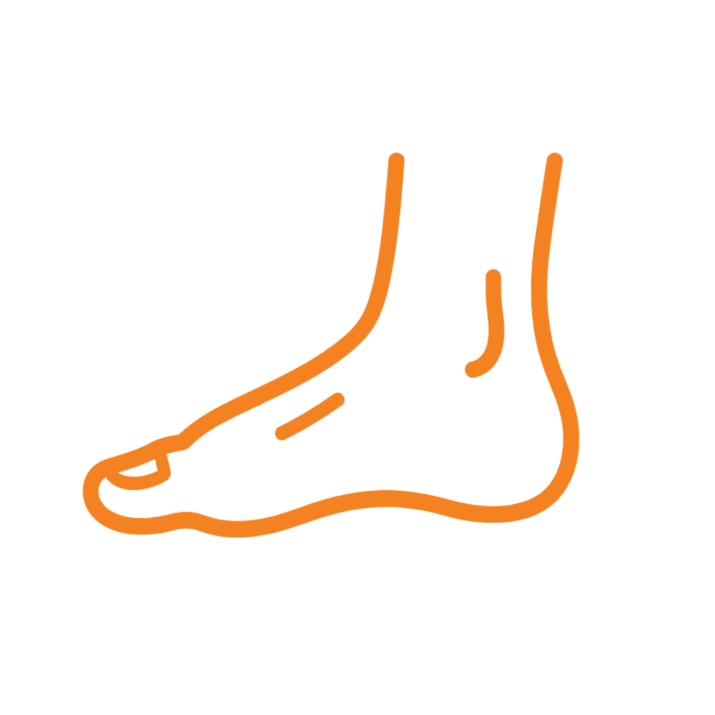 Plantar Fasciitis