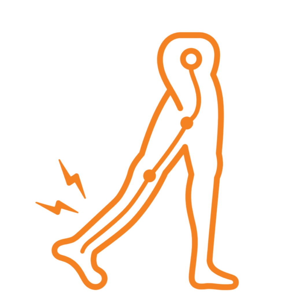 Sciatica